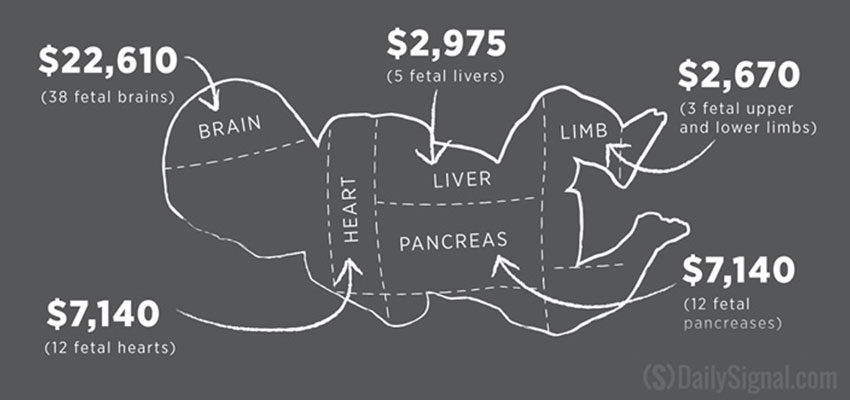 Suit claims companies illegally profited from sale of fetal tissue