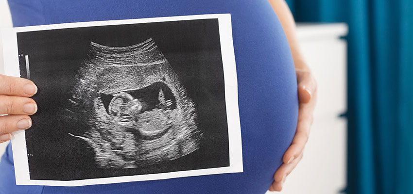 Kentucky governor stands for life